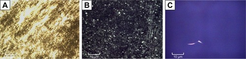Figure 2 Polarized light microscopy of formulations F1C (A), F2C (B), and F3C (C). Magnification 20×.