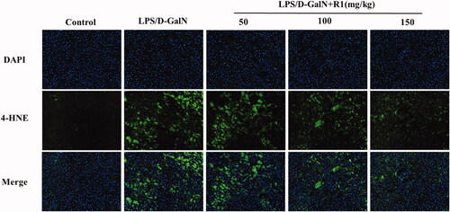 Figure 6. 4-HNE immunofluorescence staining of mouse liver. Positive expression is strong green fluorescence, and blue indicates nuclear staining.