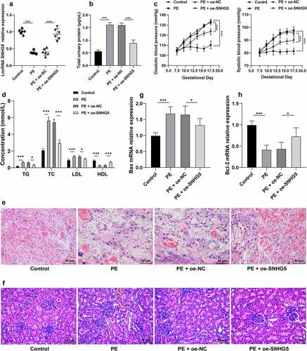 Figure 1. SNHG5 is poorly expressed in PE mice, and SNHG5 overexpression alleviates PE phenotype and tissue injury in PE mice. The PE mouse model was established, with healthy mice as the control; and pCDNA3.1-SNHG5 was injected into mice via tail vein, with pCDNA3.1-NC injection as the control. (A) SNHG5 expression pattern in mouse placental tissues was detected by RT-qPCR. (B) proteinuria was extracted from mice using the easy ll Protein Quantitative kits. (C) blood pressure was determined by the tail-cuff technique. (D) levels of TG, TC, LDL, and HDL were measured using the lipid biochemical assay kits. E and F, placenta tissue (e) and kidney tissue (f) were observed by H&E staining. (G) and (H) mRNA expression patterns of Bax (g) and Bcl-2 (h) were assessed by RT-qPCR. The results were presented as mean ± standard deviation. One-way ANOVA was used to analyze the data in panels (A), (B), (G), and (H), and two-way ANOVA was used to analyze the data in panels (C) and (D). Tukey’s multiple comparisons test was applied for the post hoc test. * p < 0.05, ** p < 0.01, *** p < 0.001.