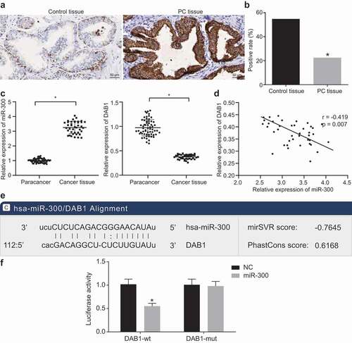 Figure 2. miR-300 targets DAB1 and exhibits an important role in the progression of PC tissues indicated by dual-luciferase reporter gene assay, immunohistochemistry, and RT-qPCR