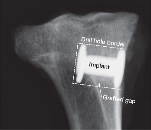 Figure 1. Gap-implant in the proximal tibia. Radiograph taken post mortem.