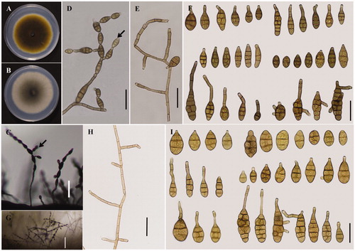 Figure 1. Morphological characteristics of Alternaria sp. YZU 171921 from Pyrus sinkiangensisi. Colony on PDA (A) and (B); sporulation patterns, conidiophores and conidia on the PCA (C)–(F); sporulation patterns, conidiophores and conidia on the host plant (G)–(I). Bars: (D)–(F) = 25 μm, (H) and (I) = 25 μm, (C) = 100 μm, (G) = 100 μm.