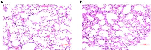 Figure 1 H&E staining of lung tissue from: (A) control group and (B) radiation-induced lung injury (IR) group at 48 h after radiation. Compared with the control group, the irradiated lungs showed thickened alveolar walls, alveolar septal edema, and massive inflammatory cell infiltration in the alveoli.