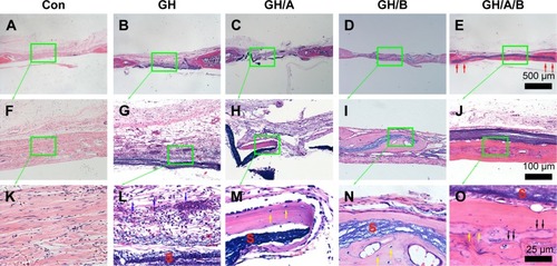 Figure 6 H&E staining of bone defect area at 6 weeks postsurgery.Notes: (A, F, and K) Con group; (B, G, and L) GH implantation group; (C, H, and M) GH/A implantation group; (D, I, and N) GH/B implantation group; and (E, J, and O) GH/A/B implantation group. S: scaffold remnants; red arrows indicate the ends of GH/A/B scaffolds, which were embedded in the newly formed bone; black arrows: bone deposition line. Yellow arrows: osteocytes embedded in bone matrix. Blue arrows: inflammatory cells. Green rectangular box together with green arrow point to its enlarged image. (A–E) The same scale bar of 500 μm, (F–J) the same scale bar of 100 μm, and (K–O) the same scale bar of 25 μm.Abbreviations: Con, control; GH, gelatin/hydroxyapatite.