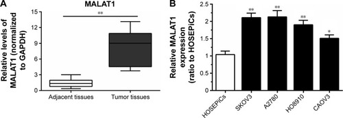 Figure 1 Long noncoding RNA MALAT1 was specifically upregulated in ovarian cancer tissues and cell lines.