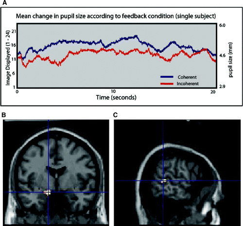 Figure 3.  (A) Mean change in pupil size in observed image across time for coherent and incoherent feedback. (B) Main effect of increasing variance in observed pupil size in the left amygdala. (C) Right superior temporal sulcus. Activations plotted at p=.005 for illustration, only clusters of 50 or more voxels shown.