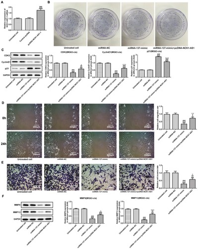 Figure 6 Overexpression of miRNA-137 represses cell proliferation, invasion and migration of MG63-cis cells. (A) qRT-PCR was employed to measure the expression level of NCK1-AS1 in MG63-cis cells after transfection of pcDNA-NCK1-AS1. (B) The colony formation assay was applied in MG63-cis cells transfected with miRNA-137 mimic or/and pcDNA-NCK1-AS1. (C) The levels of CDK2, cyclinE1 and p21 were evaluated in MG63-cis cells transfected with miRNA-137 mimic or/and pcDNA-NCK1-AS1. The migratory and invasive capacity of MG63-cis cells were measured by wound healing assay (D) and transwell assay (E), respectively. Image magnification: 100×. (F) MMP9 and MMP13 level in MG63-cis cells was altered by transfection of miRNA-137 mimic or/and pcDNA-NCK1-AS1. The data are shown as the means ± SD. *P < 0.05, **P < 0.01, ***P < 0.001 vs. Untreated cells; #P < 0.05, ##P < 0.01, ###P < 0.001 vs. miRNA-NC group; △P < 0.05, △△P < 0.01, △△△P < 0.001 vs. miRNA-137 mimic.