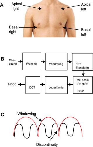 Figure 1 (A) Chest sound auscultation and recording areas. (B) MFCC feature extraction steps. (C) Computation windowing and frame continuing.