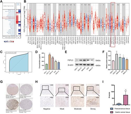 Figure 1 Expression levels of FSTL3 in gastric cancer (GC). (A-B) Differences in FSTL3 expression between different types of human cancers (*P < 0.05, **P < 0.01, ***P < 0.01). (C) Receiver operating characteristic (ROC) curves and area under the curve (AUC) values for the utility of FSTL3 expression in distinguishing GC from healthy tissue (n = 32). (D-F) Differential expression of FSTL3 in normal gastric epithelial cells and GC cells (*P < 0.05, **P < 0.01). (G) Representative immunohistochemistry images of FSTL3 staining in GC tissues and normal gastric tissues (Human Protein Atlas). (H) Representative images of different immunohistochemical staining intensities for FSTL3. (I) Statistical comparison of FSTL3 expression levels (H‑SCORE) in paracancerous and GC tissue (n=10) (**P < 0.01).