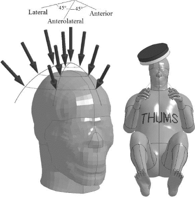 Figure 1 Impact vectors (left) and 45° anterolateral setup (right).