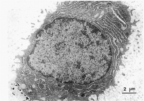 Figure 7. Ultrastructure of a chondrocyte in the fibrocartilage layer showing the cytoplasm with a fairly extensive rough endoplasmic reticulum, a moderate number of mitochondria, and well-developed Golgi apparatus, indicating high metabolic activity (×4,800).