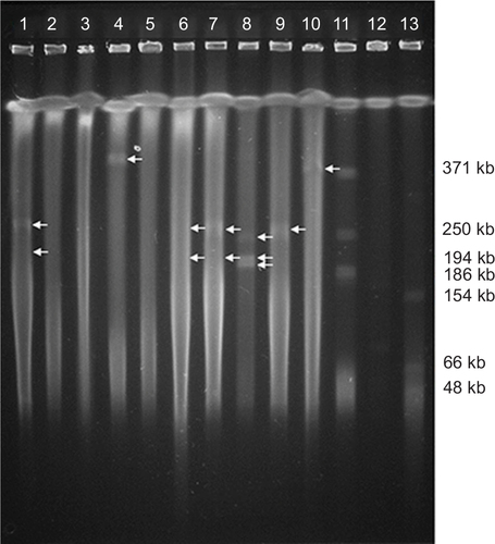 Figure 3 PFGE-S1 plasmids of 10 clinical isolates of P. aeruginosa carrying blaIMP.
