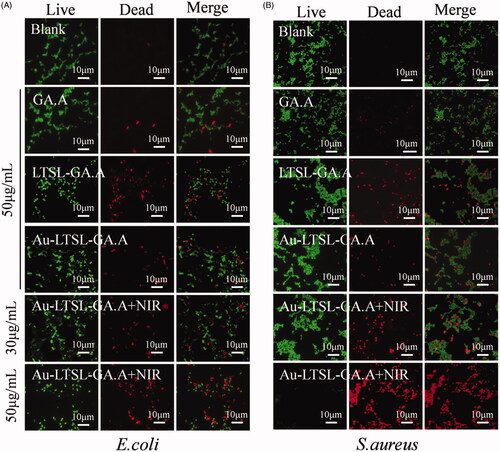 Figure 3. Fluorescence microscopic images of drug-resistant E. coli (A) and S. aureus (B) through the LIVE-DEAD stained assay. Cells treated with GA.A (50 μg/mL), LTSL-GA.A (50 μg/mL), Au-LTSL-GA.A (50 μg/mL) were set as control groups. Cells were treated with different concentration of Au-LTSL-GA.A (30 and 50 μg/mL) for 2 h in incubation and measured for 5 min upon irradiation (0.25 W/cm2). Cells were stained (for 30 min) with SYTO9 and PI for antibacterial activity. Overlay images were compared for the two kinds of cell. Bacteria without NPs were as blank.