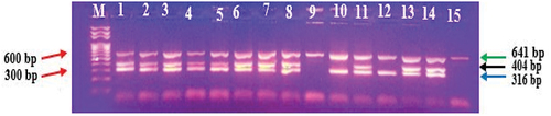 Figure 2. Multiplex bands of specific 16S gene regions in red complex pathogens for CP group.