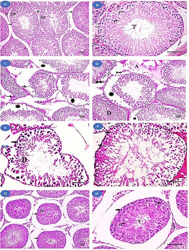 Figure 3. Histological examination of the testis from the studied groups. (A, B) Normal control and fisetin groups with normal seminiferous tubules (→) lined with spermatogenic cells (SP) and Sertoli cells (zigzag arrow). Interstitial tissue (a star) between the tubules can be seen. The layers of spermatogenic cells are observed. Spermatogonia (thick arrow), primary spermatocyte (arrowhead), rounded spermatids (curved arrow), and sperm tail (T) can all be seen. (C-F) The MSG-treated group showing an abnormal increase in the spaces between the seminiferous tubules with irregular outlines (→) and focal separation of their basement membrane (bifid arrows). Wide intercellular spaces and separation (Asterix) between spermatogenic cells are observed. Homogenous acidophilic material (A) is observed between these tubules. There is an apparent decrease in the layers of spermatogenic cells and spermatogonia (thick arrow) with dark nuclei and vacuolated cytoplasm. Vacuoles (V) are seen between spermatogenic cells and desquamated cells (D) in the lumen. Leydig cells (feathered arrows) with dark nuclei and vacuolated cytoplasm. (G, H) fisetin + MSG group showing improvement in the architecture of the seminiferous tubules (→), with wide spaces between them and nearly normal spermatogenic cells (SP). Spermatogonia (thick arrow), primary spermatocyte (arrowhead), spermatid (curved arrow), sperm tail (T), and interstitial tissue (star) are nearly normal structure. Hematoxylin and eosin staining (A, C, D, G) (×200, scale bar = 50 µm) and (B, E, F & H) (×400, scale bar = 70 µm).