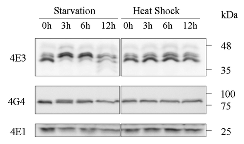 Figure 3. LeishIF4E-3 changes its pattern of expression only during nutritional stress. Wild type L. amazonensis promastigotes were subjected to nutritional starvation or heat shock (33°C) for 3, 6 or 12 h. Whole cell extracts were separated by SDS-PAGE and subjected to western analysis using specific antibodies against LeishIF4E-1, LeishIF4E-3 or LeishIF4G-4. LeishIF4E-1, which remains unchanged throughout differentiation, served as the loading control.