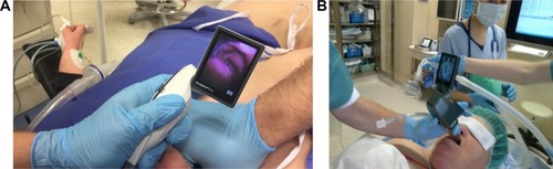 Figure 4 Images obtained from the same patient with two devices.