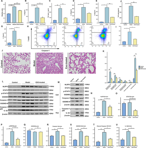 Figure 4 Mitigation of Sepsis-Induced ARDS by Alleviating Macrophage Pyroptosis with BMSC-Derived Exosomes. (A) The lung W/D ratio was assessed to evaluate lung edema. (B–D) The levels of inflammatory and pyroptosis-related factors in the cell supernatant were assessed via ELISA:IL-6 (B), TNF-α (C), IL-18 (D). (E–G) The levels of inflammatory and pyroptosis-related factors in the BALF were assessed via ELISA:IL-6 (E), TNF-α (F), IL-18 (G). (H) Flow cytometry analysis of Caspase-1/7-AAD staining and quantification of the Pyroptotic macrophages. (I) Flow cytometric analysis of the percentage of pyroptosis macrophages. (J) Histopathological images of lung tissue (×400 magnification). (K) lung injury score based on pathological images of lung tissue. (L) NLRP3, STAT3, P-STAT3, GSDMD, Caspase-1,GSDMD-N, cleaved caspase-1, IL-1β and β-actin expressions of differently treated mice were detected by Western blot. (M) Western blot was performed to assess protein expression in J774a.1 cells following different treatments (Cell represents proteins extracted from within the cells, Sup represents proteins extracted from the cell supernatant). (N–U) Bar charts quantify the relative expression levels of various proteins in lung tissue. (Control, control group; Model, pyroptosis modeling group; EXO-treated, treated with exosomes following pyroptosis modeling.) Every experiment was repeated at least three times, and the data was shown as mean ± SEM (ns: no difference,*P<0.05,**P<0.01, ***P<0.001).