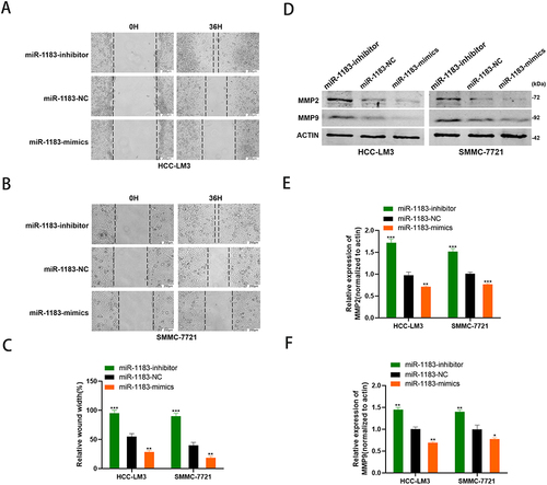 Figure 3 MiR-1183 suppresses cell migration of HCC cells. (A–C) Effect of miR-1183 on migration in HCC-LM3 and SMMC-7721 cells by wound healing assays. (D–F) Effect of miR-1183 on migration in HCC-LM3 and SMMC-7721 cells by Western blot. *p < 0.05; **p < 0.01; ***p < 0.001.