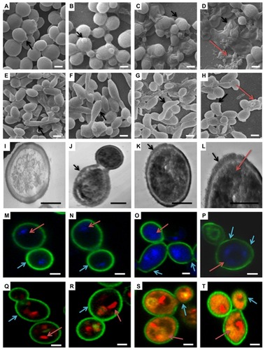 Figure 8 (a–t) Morphological, cytological, and cytometabolic effects of GNP–MB (20 μg/mL; MB) conjugate on Candida biofilm. Here, morphology of Candida biofilm showed by scanning electron micrographs (a–d) 12-hour-grown biofilm; (e–h) 24-hour-grown biofilm); (b and f) GNP-treated Candida biofilm; (a and e) control. (c, d, g and h) Effects of GNP–MB conjugate on Candida biofilm. (j–l) Cytological effects of GNP–MB conjugate in 12-hour-grown Candida cells represented by transmission electron micrograph; (i) control; (M–T) Candida cytological perturbations in 12-hour-grown Candida cells viewed by confocal scanning micrograph; (o, p, s and t) GNP–MB treated; (n and r) GNP-treated; (m and q) control. Bars in (a–T) are 2 μM and 1 μM, respectively.Abbreviations: GNP, gold nanoparticle; MB, methylene blue.