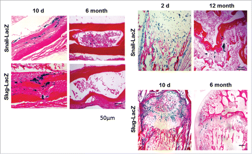 Figure 4. Expression of Snail and Slug in young versus aged mice. (A) LacZ expression in 10 day-old vs. 6 month-old parietal bone. Scale bar: 50 µm. (B) LacZ expression in 2 day-old vs. 12 month-old mice femur. (C) LacZ expression in 10 day-old vs. 6 month-old mice femur. Scale bar: 100 µm.