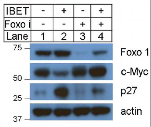 Figure 3. The effect of IBET treatment on the protein levels of p27, FOXO1 and c-Myc. The BON cells were treated with control DMSO or IBET (500 nM), for 5 days, followed by Western blotting analysis using the indicated antibodies.