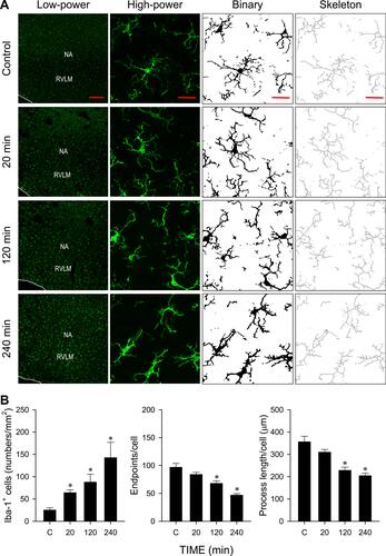 Figure 5 Cadmium induces microglia activation in RVLM. (A) Representative photomicrographs of fluorescence images and their conversion to binary and skeletonized images showing low-power or high-power views of cells in ventrolateral medulla oblongata that were immunoreactive to the reactive microglia marker Iba-1 in rats treated with cadmium (4 mg/kg). (B) Quantitative and morphology analysis of Iba-1+ immunoreactivity in RVLM using ImageJ. These results are typical of 3 animals from each experimental group. *P < 0.05 vs sham-control (C) group in the Dunnett multiple-range test. Scale bar, 200 μm in low-power view or 20 μm in high-power view, binary and skeletonized images.