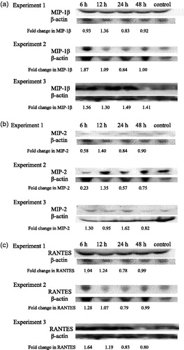 Figure 3. Time-course of changes in chemotactic cytokines in mouse serum. Effects of 6, 12, 24 and 48 h post-exposure to TBT on (a) MIP-1β, (b) MIP-2 and (c) RANTES in mouse serum. Results from three separate experiments. Primary antibodies for each of these cytokines were specific to the particular mouse cytokine and did not cross react with other mouse cytokines.