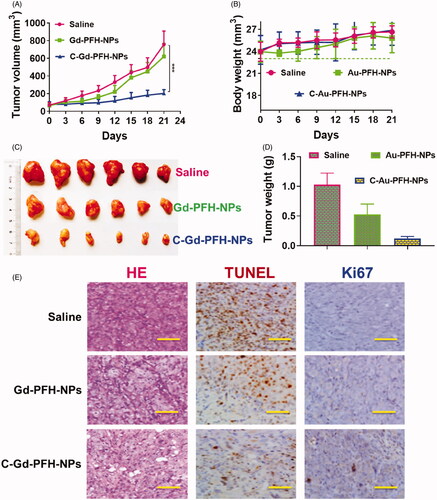 Figure 7. In vivo antitumor activity of Saline, Gd-PFH-NPs, and C-Gd-PFH-NPs compared to saline. C643 tumor xenograft-bearing BALB/c nude mice were administered with various drugs via intravenous injection at days 0, 3 and 6. A) Changes in tumor volumes. B) Body weights. C) Represent tumor photograph. D) Tumor weights. The data are presented as the means ± SD (n = 7). E) Representative H&E staining, Ki67, and TUNEL histopathological analysis of the tumors. ***p ≤ .005, compared to each normalized control.