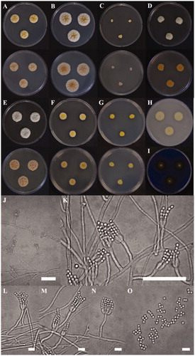 Figure 3. Morphological characteristics of Penicillium ulleungdoense (KACC 48990) grown on different media. (A) CYA 25 °C, (B) CYA 30 °C, (C) CYA 37 °C, (D) MEA 25 °C, (E) YESA 25 °C, (F) CYAS 25 °C, and (G) CZ 25 °C (top: obverse, bottom: reverse); (H) Colony on OA 25 °C; (I) Colony on CREA 25 °C; (J–N) Conidiophores; (O) Conidia (Scale bar = 50 μm in J–K. Scale bar = 10 μm in L–O).