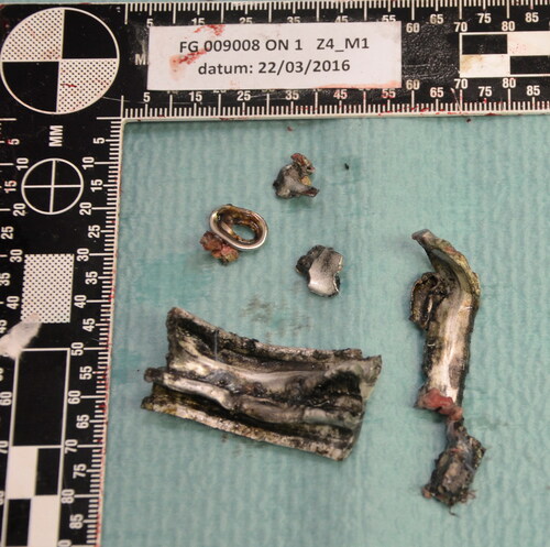 Figure 4. Removed shrapnel (undefined metal devices, probably scrap).