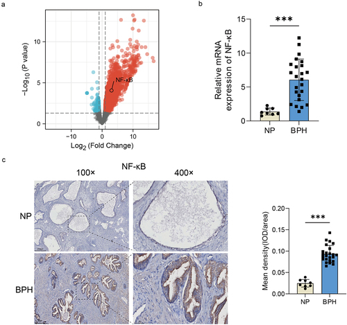 Figure 5. The increase of NF-κB expression in BPH tissues. (a) Volcano map of DEGs after urethral bacterial instillation based on GSE179655. blue dots: down-regulated genes; red dots: up-regulated genes; gray dots: no significant difference. (b) transcription levels of NF-κB by qRT-PCR in BPH and normal tissues. (c) Representative images of IHC for NF-κB in prostate sections from BPH and normal groups. Quantification bar graph showing the extent of NF-κB staining in the form of mean density calculated by IOD/area. Data are shown as mean ± SD, Student’s t-test; ***p < 0.001.