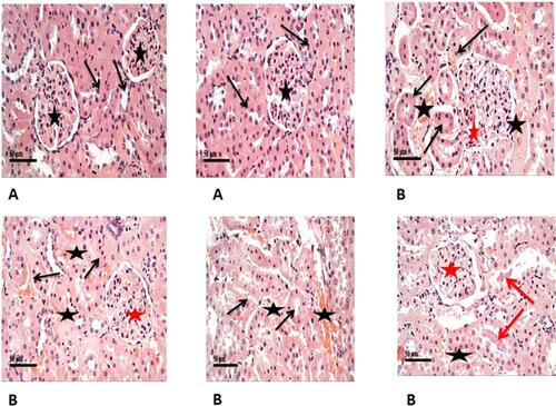 Figure 3 Shows H&E staining of histopathological changes in the groups of kidney tissues (400×). (A) Control samples had normal morphological features of renal parenchyma with apparent intact renal corpuscles (stars) and different nephron segments displaying apparent intact renal tubular epithelium (arrows) as well as intact vasculature. (B) Model samples showed the effect of STZ on histological structure of kidneys showed marked congestion of renal glomeruli (red stars) as well as many dilated and congested intertubular blood vessels (black stars). Frequent records of degenerative or necrotic changes of renal tubular epithelium in proximal and distal convoluted tubules with significant records of pyknotic nuclei (black arrows) and occasional intraluminal eosinophilic casts (red arrows).