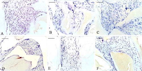 Figure 6. Negative controls for immunohistochemistry: at the 2-week time point (A–C) and the 8-week time point (D–F). EPB (A and D), PB (B and E) and B (C and F) implants.