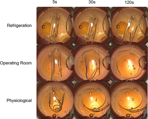 Figure 6 Representative IOL unfurling in OVD-filled plastic eye. IOLs often failed to unfurl within 10 minutes using refrigerated OVD. Average IOL unfurling time in across dispersive and cohesive OVD was under 200s using operating room temperature OVD and under 45s using physiological temperature OVD. Displayed: cohesive OVD.
