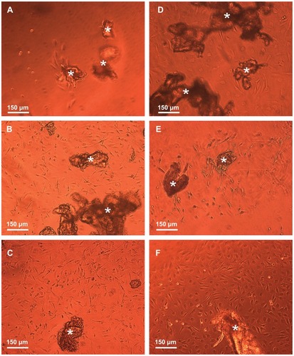 Figure 9 Phase-contrast microscope images illustrating the effect of the free and conjugated bFGF on the migration and growth of the NOM cells from the cells/free or conjugated bFGF/MCs aggregates, 18 days after the cultivation of the cell aggregates in the magnetic fibrin hydrogel scaffolds. (A) exhibits the effect of the naked γ-Fe2O3 nanoparticles (control), (B) the effect of the physically conjugated bFGF nanoparticles, (C) the effect of the covalently conjugated bFGF nanoparticles. The effect of the same concentration of the free factor as that of the conjugated bFGF, and 5 and 10 times higher is illustrated in images (D), (E), and (F), respectively.Note: The asterisks indicate some of the NOM cells/bFGF-γ-Fe2O3/MCs aggregates.Abbreviations: bFGF, basal fibroblast growth factor; MC, chitosan microcarriers; NOM, nasal olfactory mucosa.