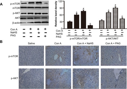 Figure 5 H2S activates PtdIns3K-AKT1 signaling in Con A-induced hepatitis in mice.