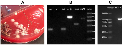 Figure 3 The string test was performed using an inoculation loop to evaluate for hypermucoviscosity. (A) Formation of mucoviscous strings >5 mm in length was defined as a positive result. (B and C) Agarose gel electrophoresis revealed that the strain carried rmpA, rmpA2, iucA, iroB, and PEG-344 virulence genes and belonged to the K1 capsular serotype.