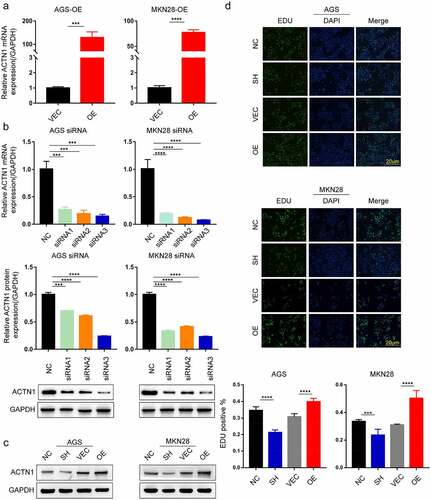 Figure 3. ACTN1 promotes the proliferation of GC. a The transfection efficiency of ACTN1 overexpression plasmid [OE] was confirmed by RT-qPCR in GC cells (with empty plasmid as negative control [VEC]). b RT-qPCR and WB analysis showed that siRNA3 had the highest knockdown efficiency (with siR-NC as negative control [NC]). c siRNA3 and ACTN1 overexpression plasmid were used for subsequent knockdown and overexpression experiments (siRNA3 [SH], siR-NC [NC], ACTN1 overexpression plasmid [OE], control plasmid [VEC]). d The proliferation ability of gastric cancer detected by EDU incorporation. The histogram of EDU-positive rate was quantified using the GraphPad, which showed that the overexpression of ACTN1 promoted the proliferation, whereas its knockdown reversed this effect (magnification: 100×; Scale bars 20um; P < 0.05 *, <0.01 **, <0.001 ***, <0.0001 ****)