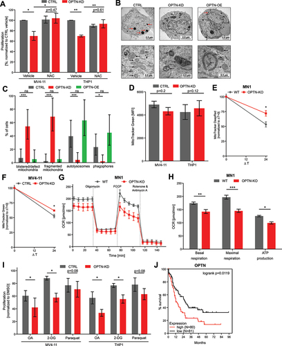 Figure 5. Loss of OPTN impairs mitochondrial function in AML cells. (A) Proliferation of MV4–11 and THP1 cells treated with 200 µM N-acetyl-L-cysteine (NAC) for 24 h after OPTN-KD. Cells were counted using erythrosine B exclusion and cell numbers were normalized to CTRL + vehicle (n = 3). (B) Representative transmission electron microscopy (TEM) images from 50-nm thin sections of plastic embedded MV4–11 CTRL, OPTN-KD, and OPTN-OE cells. Scale bar: 2.5 µM or 0.5 µm. Black arrows indicate mitochondrial structures and red arrows indicate vacuoles, most likely representing autolysosomes. (C) Quantification of cellular structures observed in TEM images shown is (B). Data are percent of analyzed cells with the described structures (CTRL = 43 cells, OPTN-KD = 48 cells, OPTN-OE = 38 cells). P value by exact Poisson statistic, error bars indicate exact 95% confidence intervals assuming Poisson distribution. Experiment was repeated with highly similar results. (D) Quantification of mean fluorescence intensity (MFI) of MitoTracker Green staining in CTRL or OPTN-KD MV4–11 and THP1 cells shown in Figure S5E (THP1: n = 3, MV4–11: n = 4). (E) Quantification of pulse-labeled mitochondria in OPTN-deficient MN1 and (F) MV4–11 cells chased for 24 h after MitoTracker Green or Deep Red staining, respectively. Data are normalized to mean fluorescent intensity after pulse labeling. ΔT = chase time after pulse labeling of mitochondria in hours (n = 3) (G) Representative mitochondrial respiration of WT and optn-KO murine MN1-driven bone marrow cells from leukemic mice was determined by measuring oxygen consumption rate (OCR). (H) Quantification of basal and maximal respiration and ATP production in WT and optn-KO MN1 cells from (G) (n = 3). (I) Cell growth analysis of human MV4–11 and THP1 cells after knockdown of OPTN in presence or absence of 1 mM 2-deoxyglucose (2-DG), 1 µM oligomycin and antimycin a (OA), or 1 mM paraquat. Cells were incubated for 24 h with inhibitors and counted using erythrosine B exclusion. Cell numbers were normalized to DMSO controls (n = 3). (J) TCGA LAML data for adult patients with de novo AML were analyzed for survival and stratified by low (below median; red) and high (above median; black) OPTN mRNA expression. Student’s t-test was performed in (A, C-F, H and I). Values are means ± SEM. Note: *p < 0.05, **p < 0.01, ***p < 0.001.