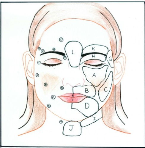 Figure 6 Drawing of face with zones and ports.
