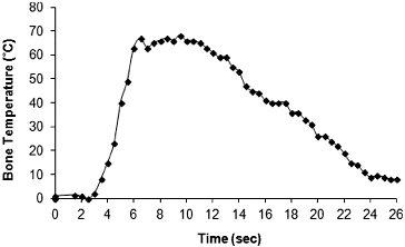 Figure 2. Temperature evolution in bone during the drilling operation.