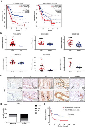 Figure 1. MYEOV is upregulated in PDAC tissues compared with ANPTs. (a) Overall survival and disease-free survival curves for the PDAC patient groups with low and high MYEOV expression in TCGA database. (b) MYEOV was highly expressed in PDAC tissues compared with normal pancreas tissues according to an analysis of data from TCGA GTEx and GEO. (c) Standard immunohistochemical scoring pictures of MYEOV expression in 90 pancreatic cancer tumors and adjacent normal tissues. (d) The protein expression level of MYEOV in TMA. (e) Overall survival curves for the PDAC patient groups with low and high MYEOV expression in TMA.