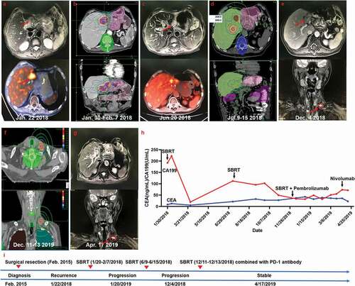 Figure 3. Summary of imaging scans and timeline of therapy and disease status for Case 3