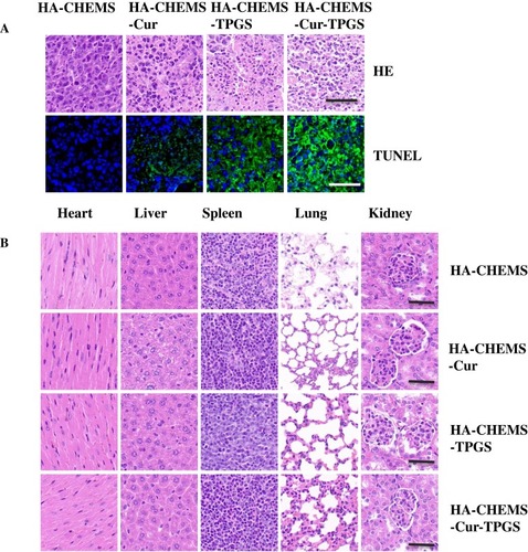 Figure 7 H&E and TUNEL staining assays of tumor (A) and health organs (B) in different treatment groups. All the scale bars present 100 µm.