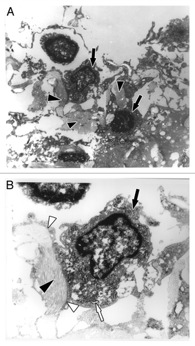 Figure 7. Ultrastructure of fibroblasts immobilized in a matrigel plug after one week of subcutaneous implantation by transmission electron microscopy. (A) The implanted fibroblasts produced collagen in the matrigel (black arrowhead indicates collagen; black arrows indicate fibroblasts); amplification, 6,500x. (B) Magnified view of a fibroblast (black arrow), well-developed rough endoplasmic reticulum (white arrow) indicating high protein synthesis, collagen (black arrowhead) surrounded by filopodia extensions of fibroblasts (white arrowhead); amplification, 17,500x.