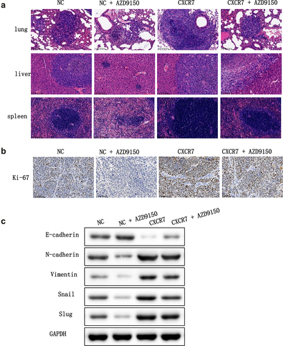 Figure 7. The effect of CXCR7/CXCL12/STAT3 axis on the growth and metastasis of EC cells in vivo. (a) HE staining was conducted to observe the metastasis of cancer cells in lung, liver and spleen. (b) Expression of Ki-67 in tumor tissues was stained by IHC. (c) The expression of EMT-related proteins in tumor tissues was detected.