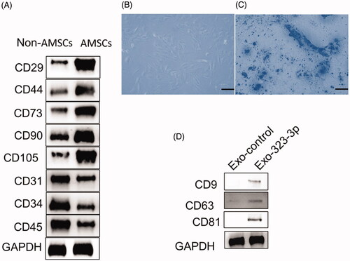 Figure 1. Identification of human adipose tissue-derived mesenchymal stem cells (AMSCs) and exosomes. (A) Western blot analysis of the surface markers in AMSCs. (B) Representative images of Human AMSCs. (D) Oil Red O straining in cumulus cells (CCs) treated with adipogenesis kit (original magnification × 100, Scale bar = 50 μm). (D) Western blot analysis of CD9, CD63 and CD81 expression in AMSC exosomes. “Exo-control” denotes precipitates from AMSCs, and DMEM were used as a negative control. “Exo-323-3p” denotes exosomes derived from modified AMSCs.