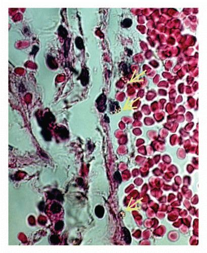 Figure 3 Light microscopy image of leukocytes containing MNPs-DMSA inside a vein. Note that the cells (yellow arrows) are close or attached to the endothelium.