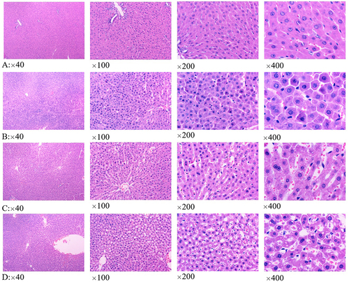 Figure 2 Liver histopathological results of different groups. (A–D) were the results of control group, HS(Tc) group, HS(Tc-1°C) group and HS(Tc+1°C) group, respectively.
